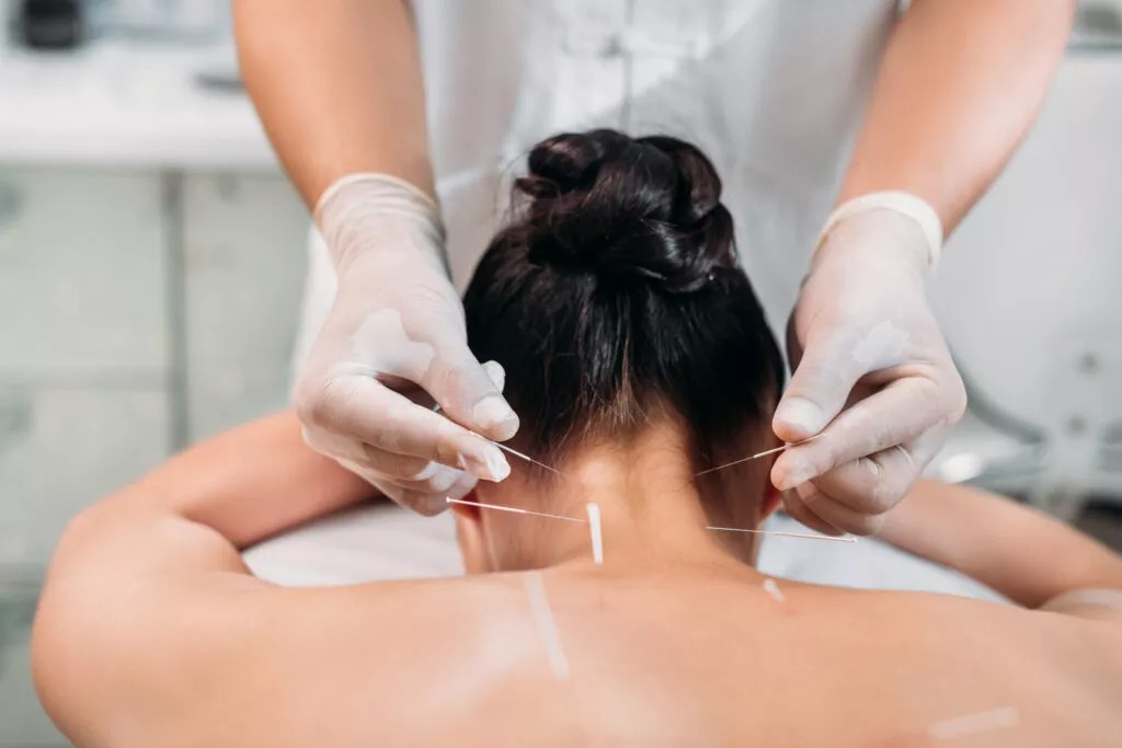 Ετοιμάζουν νόμο για βελονισμό, τεχνικές λέιζερ και βοτανολογία – Αντιδρούν οι γιατροί